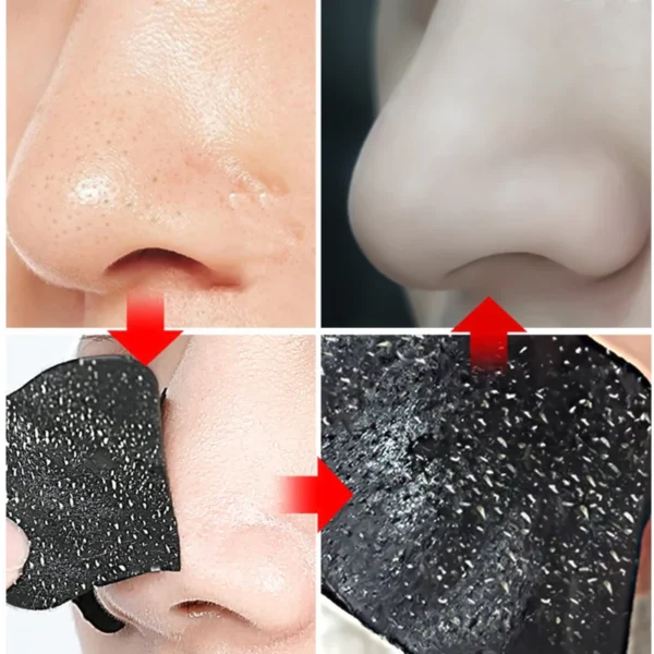 10/20/50pcs Nose Strips For Blackheads Acne Removal Instant Pore Unclogging Strips Deep Cleansing Nose Clean Patch New - Image 3
